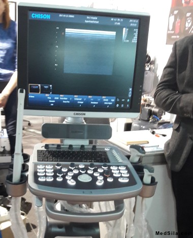 аппарат УЗИ